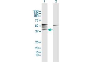 Image no. 3 for anti-Adrenergic, beta-2-, Receptor, Surface (ADRB2) (AA 1-413) antibody (ABIN513156)
