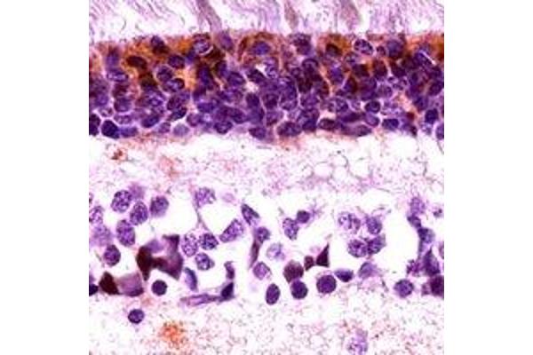 ARR3 antibody  (C-Term)