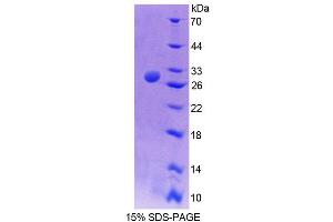 Image no. 1 for Transcription Elongation Factor A2 (TCEA2) (AA 1-218) protein (His tag) (ABIN6239528)