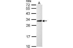 Image no. 2 for anti-Chloride Intracellular Channel 4 (CLIC4) (Center) antibody (ABIN2855985)