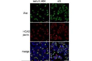 Immunostaining (ISt) image for anti-SARS-CoV-2 Spike S1 (RBD) antibody (ABIN6952546)