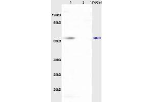 Image no. 3 for anti-Hematopoietic Cell-Specific Lyn Substrate 1 (HCLS1) (AA 161-260) antibody (ABIN709811)