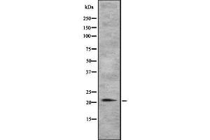 Image no. 2 for anti-TGFB-Induced Factor Homeobox 2-Like, Y-Linked (TGIF2LY) antibody (ABIN6265554)