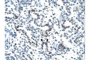 Image no. 1 for anti-EVX1 (EVX1) (AA 74-123) antibody (ABIN202451)