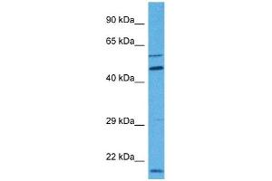 Image no. 3 for anti-Membrane Bound O-Acyltransferase Domain Containing 1 (MBOAT1) (N-Term) antibody (ABIN2783413)