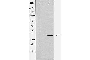 Image no. 2 for anti-Cell Division Cycle Associated 8 (CDCA8) antibody (ABIN6260693)