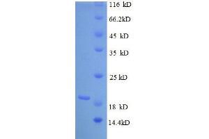 Image no. 1 for Tumor Necrosis Factor alpha (TNF alpha) (AA 78-234) protein (His tag) (ABIN1047829)