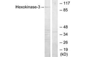 Image no. 1 for anti-Hexokinase 3 (White Cell) (HK3) (AA 811-860) antibody (ABIN1533773)