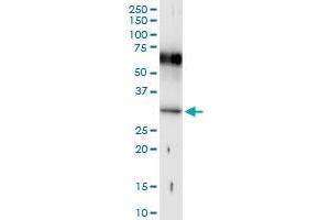 Image no. 1 for anti-Homeobox B1 (HOXB1) (AA 1-235) antibody (ABIN516625)