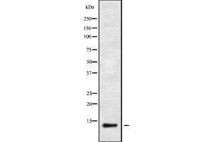 Image no. 1 for anti-Interferon, alpha-Inducible Protein 6 (IFI6) antibody (ABIN6262452)