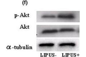 Image no. 5 for anti-V-Akt Murine Thymoma Viral Oncogene Homolog 1 (AKT1) (C-Term) antibody (ABIN94783)