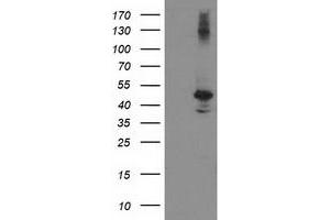 Image no. 2 for anti-Eukaryotic Translation Initiation Factor 2B, Subunit 3 Gamma, 58kDa (EIF2B3) antibody (ABIN2720067)