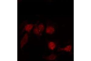 Image no. 1 for anti-G Protein-Coupled Receptor 87 (GPR87) antibody (ABIN6258195)