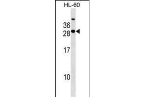 STXBP6 Antibody (Center) (ABIN1538584 and ABIN2849443) western blot analysis in HL-60 cell line lysates (35 μg/lane).