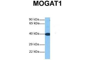 Image no. 2 for anti-Monoacylglycerol O-Acyltransferase 1 (MOGAT1) (C-Term) antibody (ABIN2784111)
