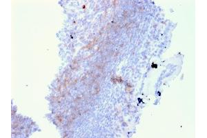 Image no. 2 for anti-CD72 Molecule (CD72) antibody (ABIN6941252)