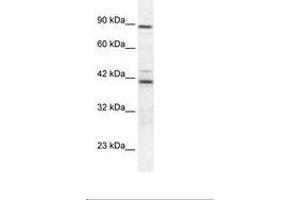 Image no. 2 for anti-T-Box 5 (TBX5) (AA 249-298) antibody (ABIN6735839)