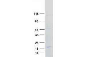 Image no. 1 for Chemokine (C-C Motif) Ligand 21 (CCL21) protein (Myc-DYKDDDDK Tag) (ABIN2714241)