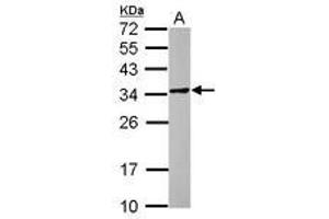 Image no. 1 for anti-POM121 and ZP3 Fusion (POMZP3) (AA 1-187) antibody (ABIN1500344)