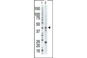 Image no. 1 for anti-Vaccinia Related Kinase 1 (VRK1) (AA 366-396) antibody (ABIN391605)
