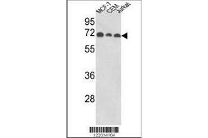 Image no. 3 for anti-Abl-Interactor 1 (ABI1) (AA 81-108), (N-Term) antibody (ABIN652475)