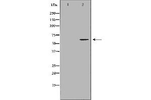 Image no. 1 for anti-Interleukin 18 Receptor 1 (IL18R1) (Internal Region) antibody (ABIN6262542)