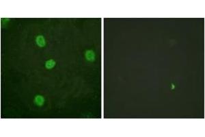 Image no. 2 for anti-V-Myb Myeloblastosis Viral Oncogene Homolog (Avian)-Like 2 (MYBL2) (AA 551-600), (pSer577) antibody (ABIN1531525)
