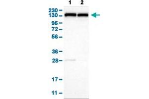 Image no. 1 for anti-Ubiquitin Conjugation Factor E4 B (UBE4B) (AA 2-67) antibody (ABIN5774346)