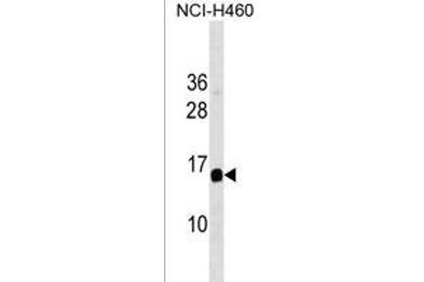 GAPT 抗体  (AA 84-112)