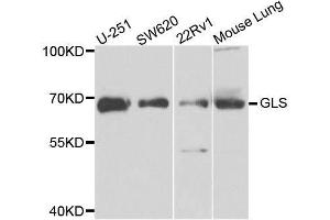 Glutaminase antibody  (AA 610-669)
