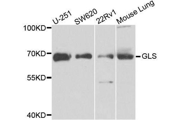 Glutaminase antibody  (AA 610-669)