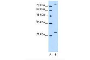 Image no. 1 for anti-Protein-L-Isoaspartate (D-Aspartate) O-Methyltransferase (PCMT1) (AA 209-258) antibody (ABIN321494)