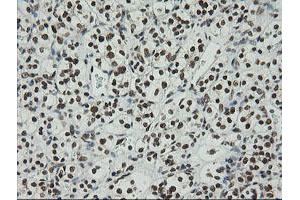 Image no. 3 for anti-Zinc Finger and SCAN Domain Containing 18 (ZSCAN18) antibody (ABIN1501857)