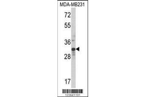 Image no. 2 for anti-MAX-Like Protein X (MLX) (AA 125-151) antibody (ABIN652578)