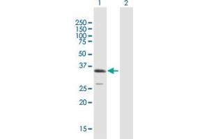 Image no. 1 for anti-UL16 Binding Protein 1 (ULBP1) (AA 1-244) antibody (ABIN1327191)