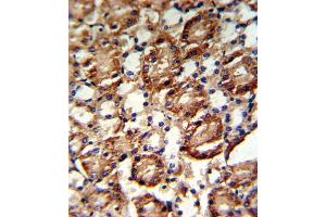 Image no. 2 for anti-Guanine Monophosphate Synthetase (GMPS) antibody (ABIN3001740)