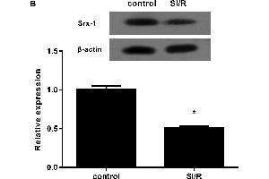 Image no. 3 for anti-Sulfiredoxin 1 (SRX1) (AA 45-137) antibody (ABIN1387599)