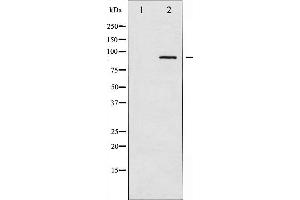 Image no. 1 for anti-Adducin 1 (Alpha) (ADD1) antibody (ABIN6259794)