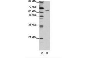 Image no. 2 for anti-Staufen Double-Stranded RNA Binding Protein 1 (STAU1) (AA 131-180) antibody (ABIN203214)