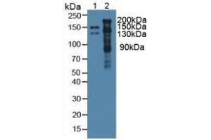 Image no. 6 for Thrombospondin 1 (THBS1) ELISA Kit (ABIN6574175)
