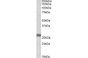Image no. 2 for anti-Synaptosomal-Associated Protein, 23kDa (SNAP23) (Internal Region) antibody (ABIN571213)