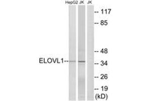 Image no. 1 for anti-ELOVL Fatty Acid Elongase 1 (ELOVL1) (AA 101-150) antibody (ABIN1534882)