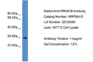 Image no. 1 for anti-Protein Kinase, CAMP Dependent, Catalytic, beta (PRKACB) (N-Term) antibody (ABIN2786690)