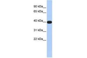 Image no. 1 for anti-LIM Homeobox Transcription Factor 1, alpha (LMX1A) (N-Term) antibody (ABIN6740305)