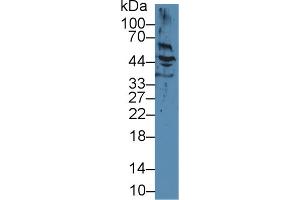 Image no. 1 for anti-Keratin 17 (KRT17) antibody (ABIN3201630)
