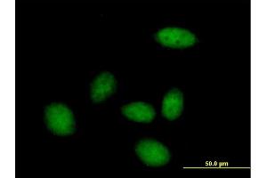 Image no. 3 for anti-Zinc Fingers and Homeoboxes 3 (ZHX3) (AA 1-969) antibody (ABIN524941)