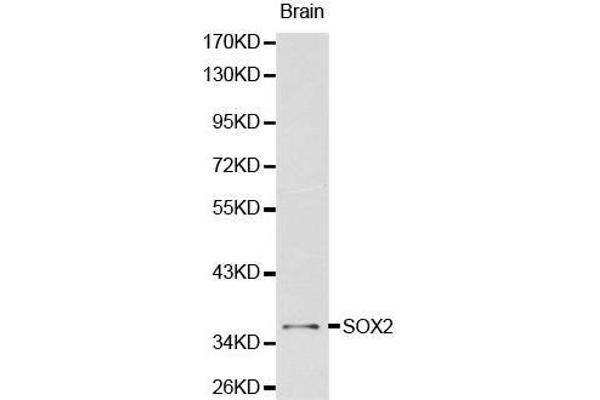 SOX2 Antikörper  (AA 1-140)