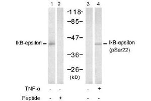 Image no. 2 for anti-Nuclear Factor of kappa Light Polypeptide Gene Enhancer in B-Cells Inhibitor, epsilon (NFKBIE) (Ser22) antibody (ABIN197570)