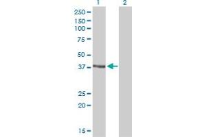 Image no. 6 for anti-DNA Repair Protein RAD51 Homolog 3 (RAD51C) (AA 1-134) antibody (ABIN562569)
