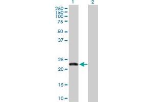 Image no. 1 for anti-F-Box Protein 36 (FBXO36) (AA 1-188) antibody (ABIN530652)